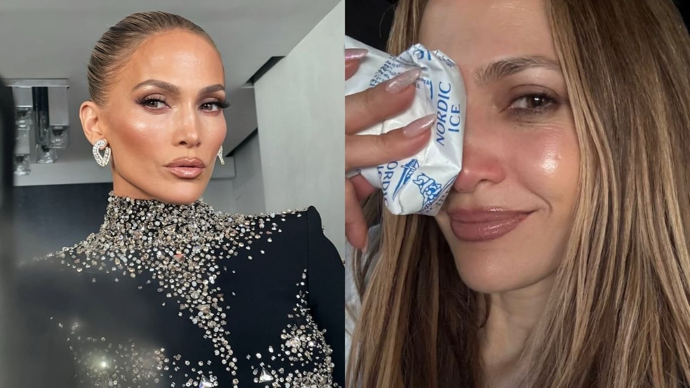 Jennifer Lopez sofre acidente em ensaio e leva pontos no nariz