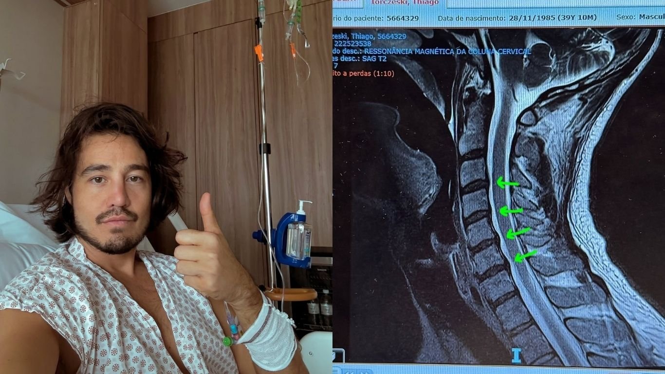Tiago Iorc é internado às pressas com crise de hérnia de disco