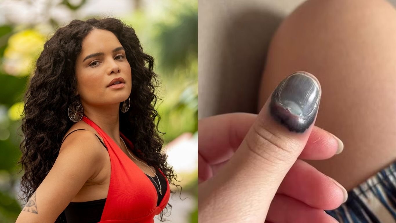 Carol Macedo passa por cirurgia após acidente com porta de carro