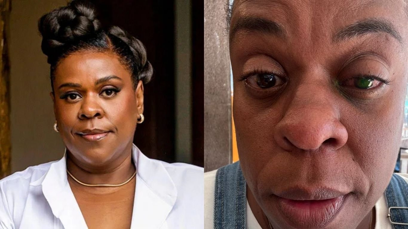 Cacau Protásio tem perda de visão após usar pomada capilar: “Muita dor”